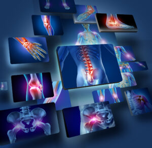 Understanding The Importance Of Personal Injury Lawyers - Human Joints Concept